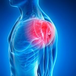 Progetto senza titolo - 3