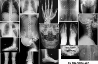 CATANIA, FOCUS SU  RADIOLOGIA HI TECH